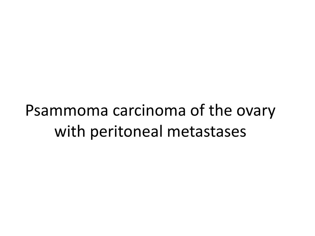 psammoma carcinoma of the ovary with peritoneal