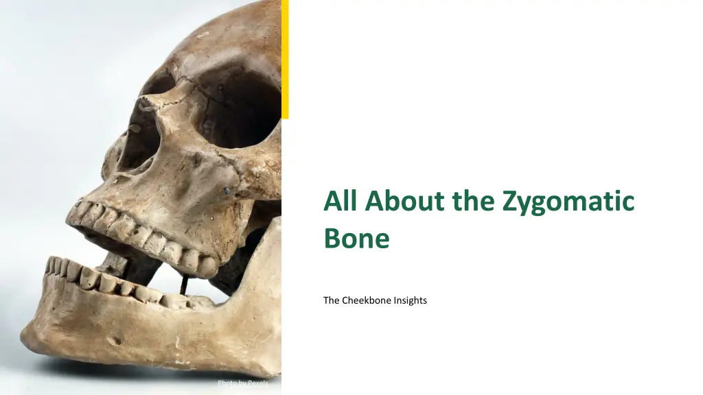 all about the zygomatic bone