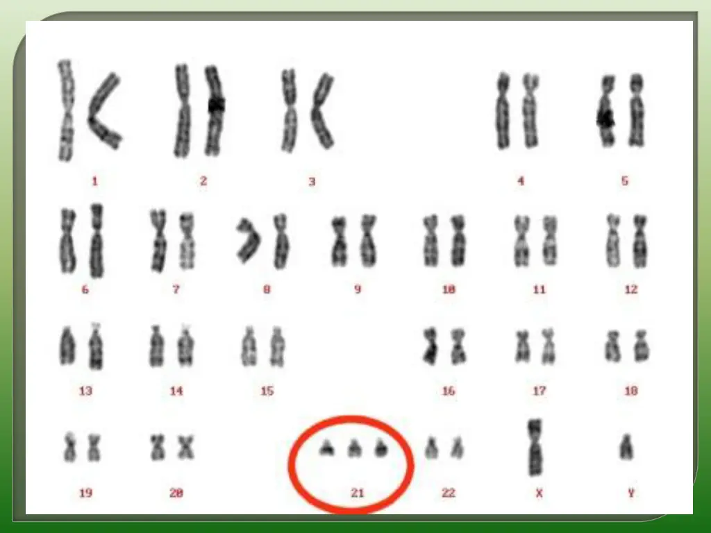 slide11