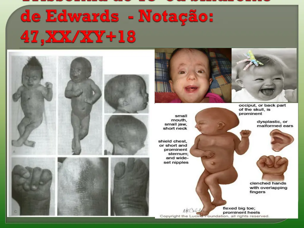 slide12