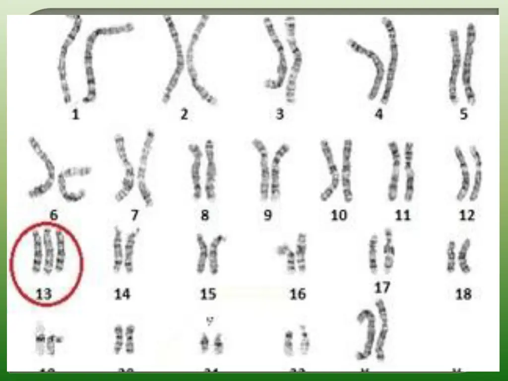 slide17