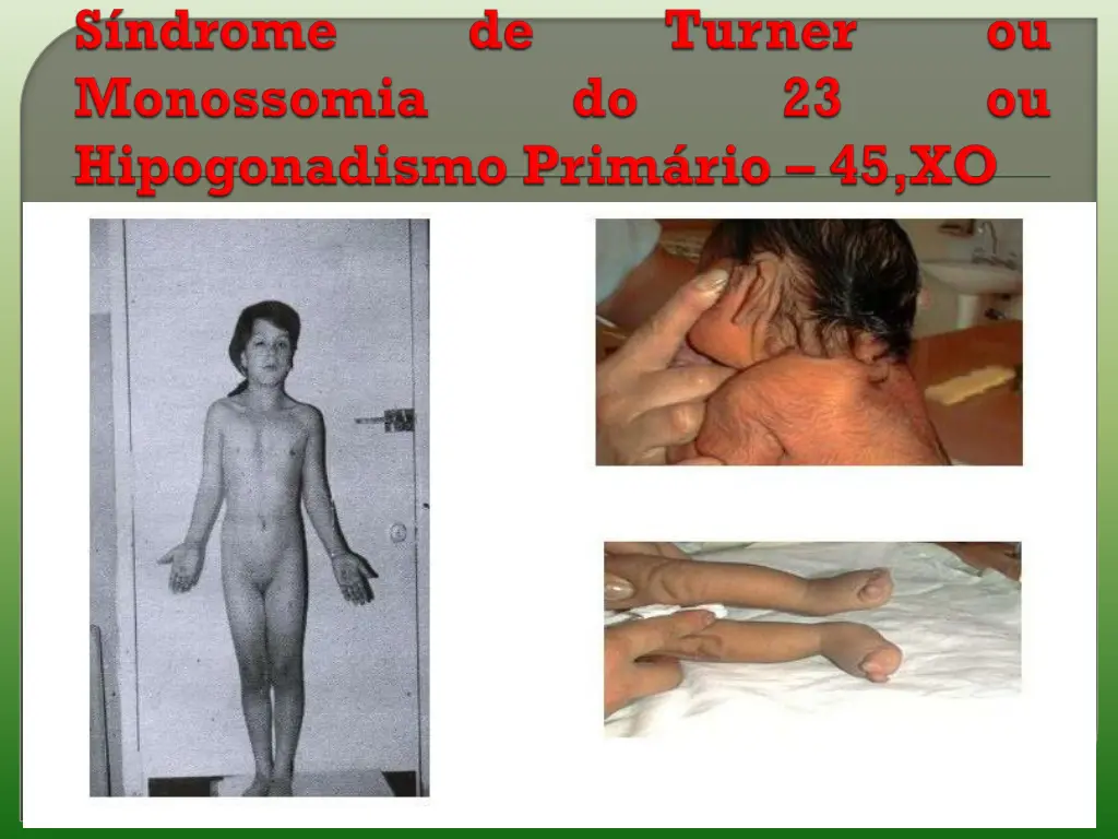 slide18