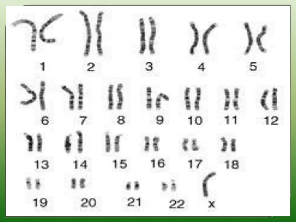slide20