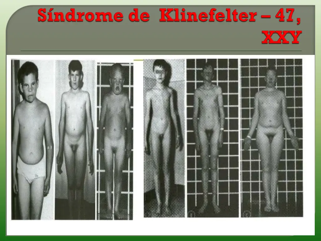slide21