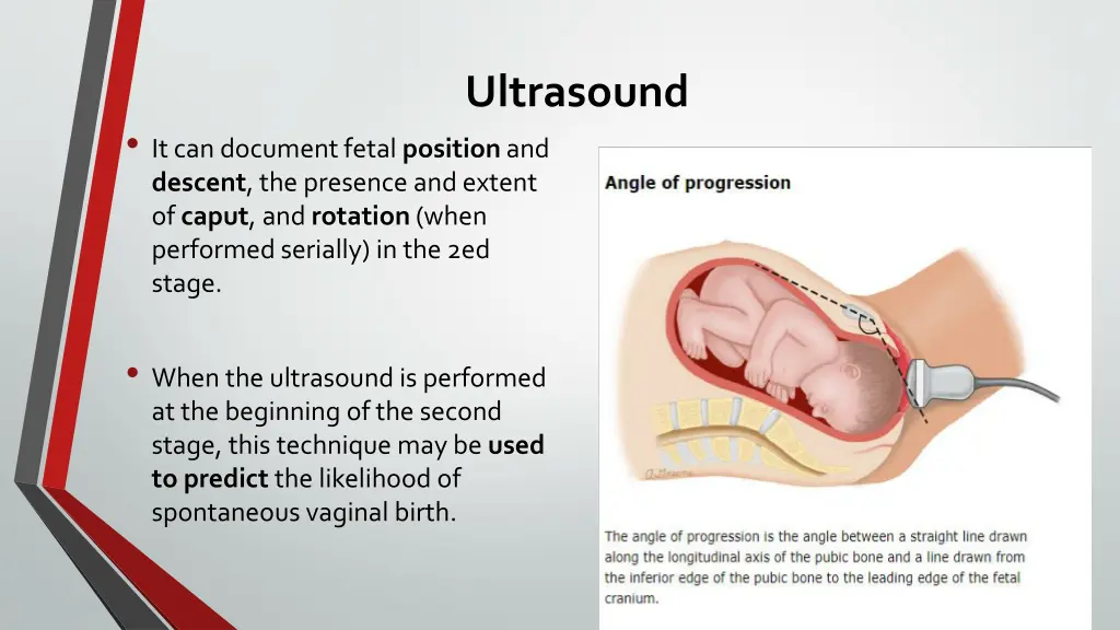 ultrasound