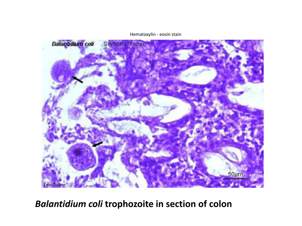 hematoxylin eosin stain