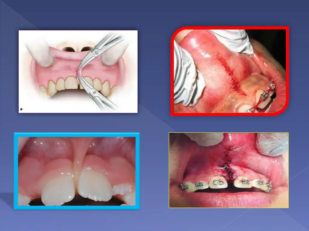 slide2