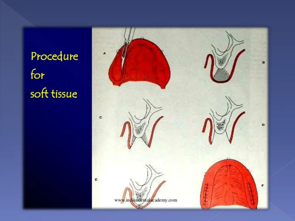 slide5