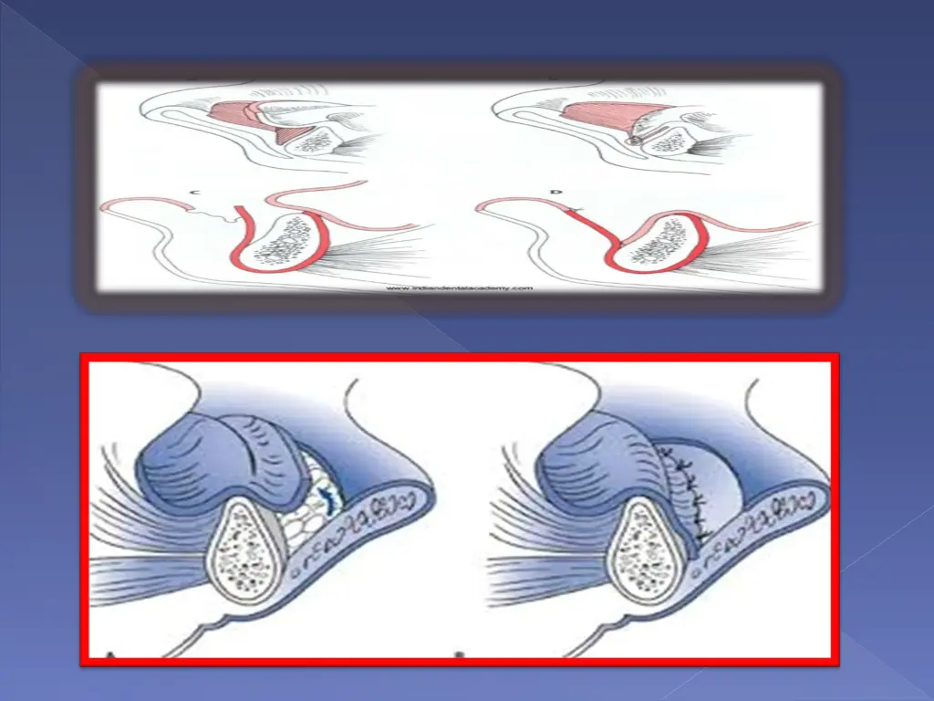 slide7