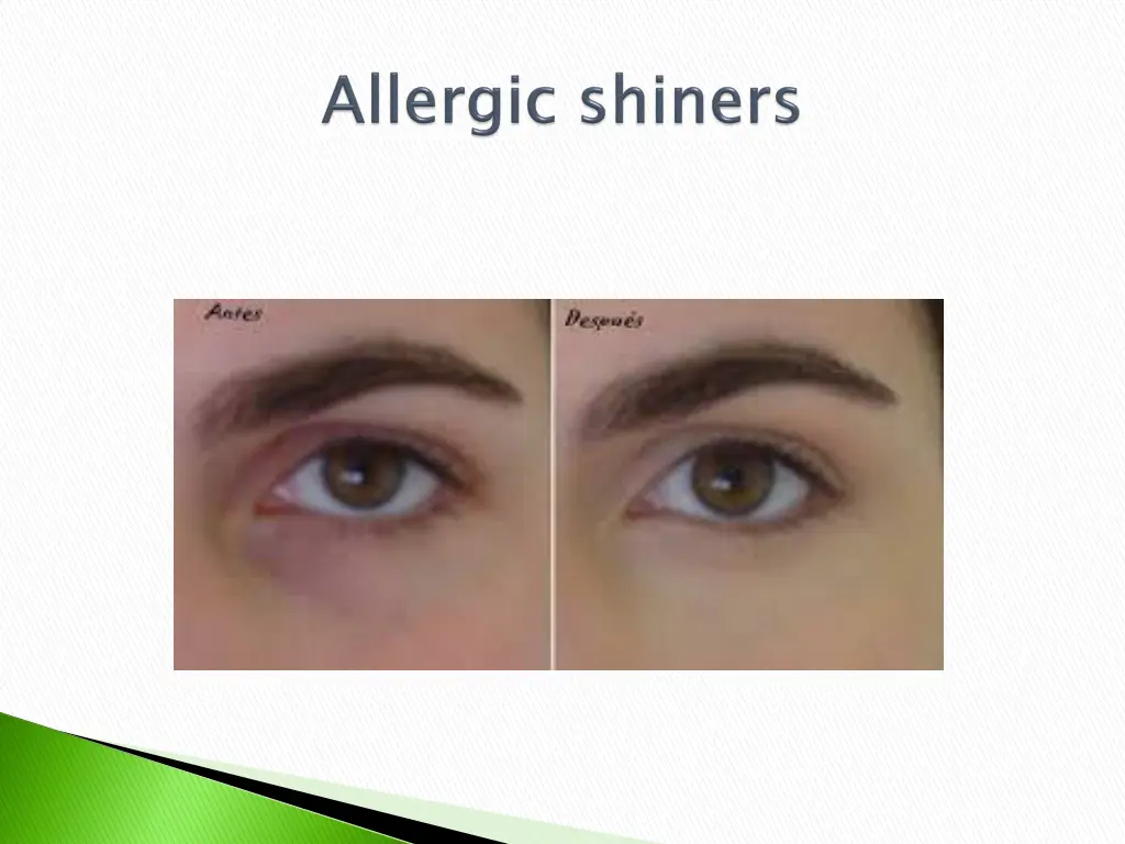 slide10