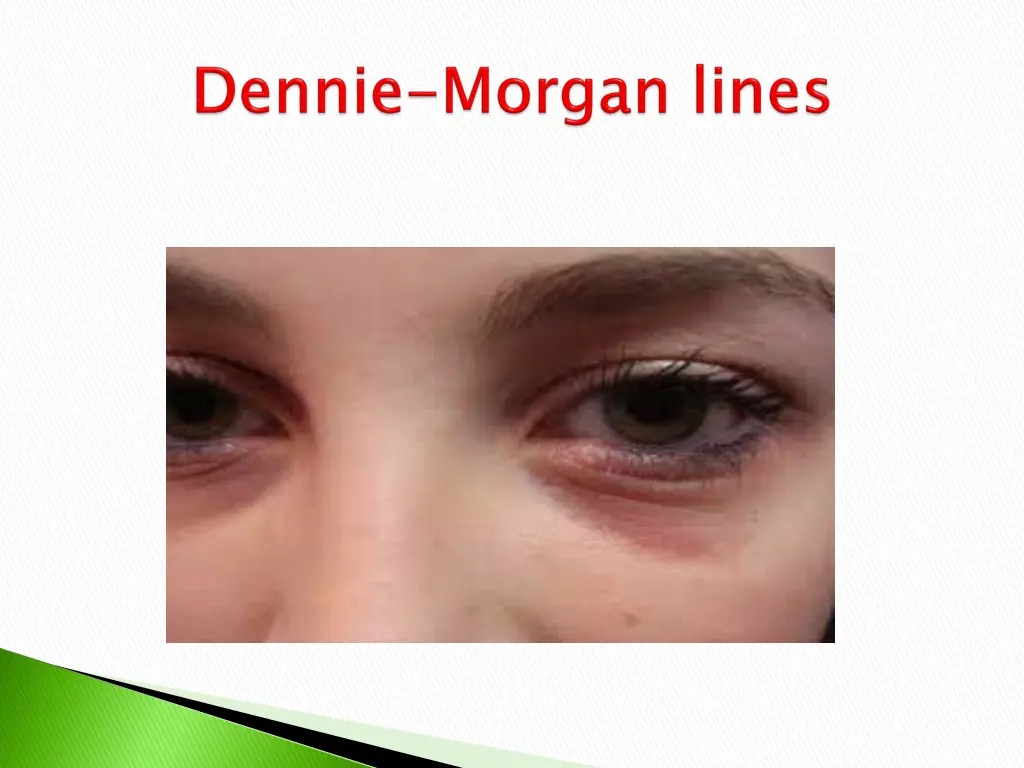 slide11