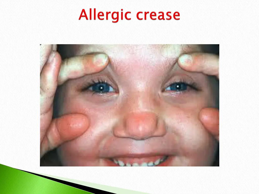 slide13