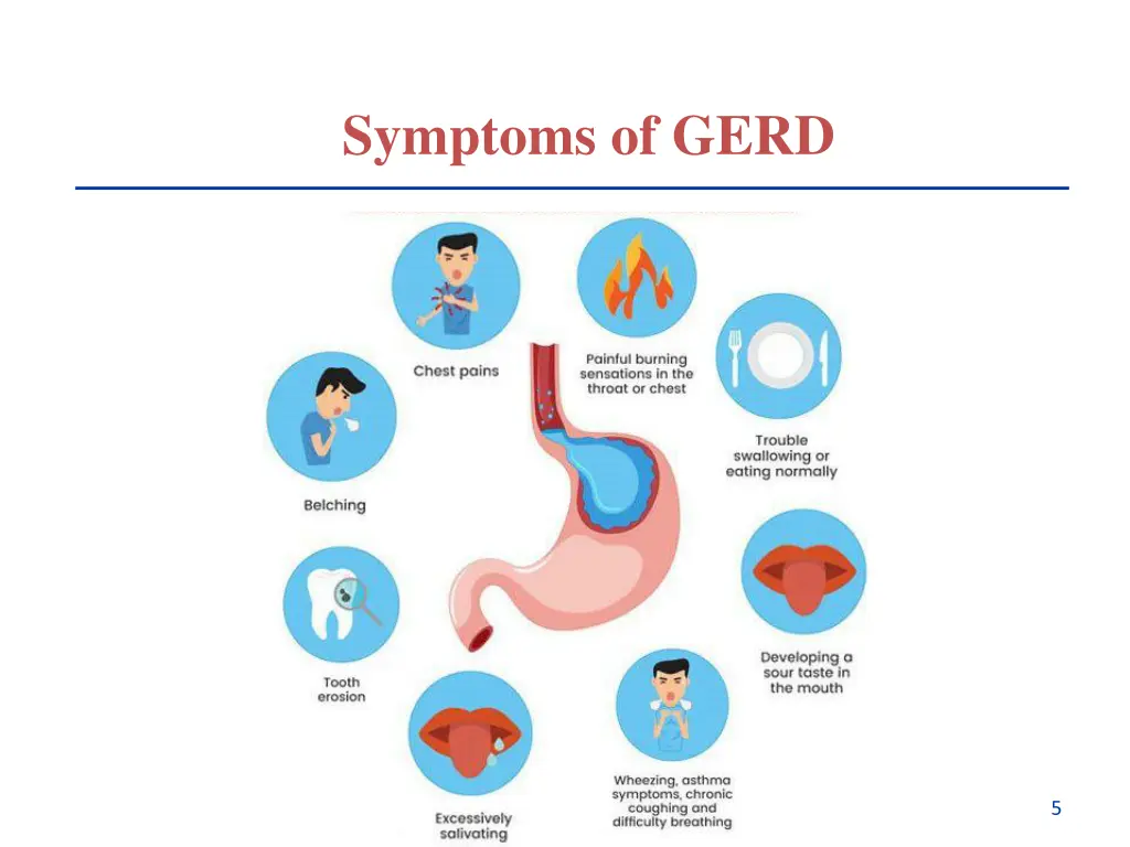 symptoms of gerd