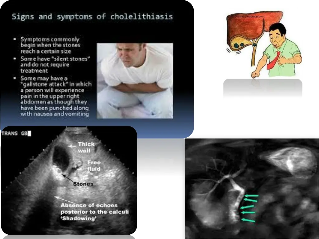 slide7