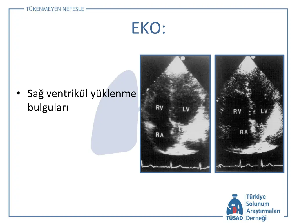 slide22