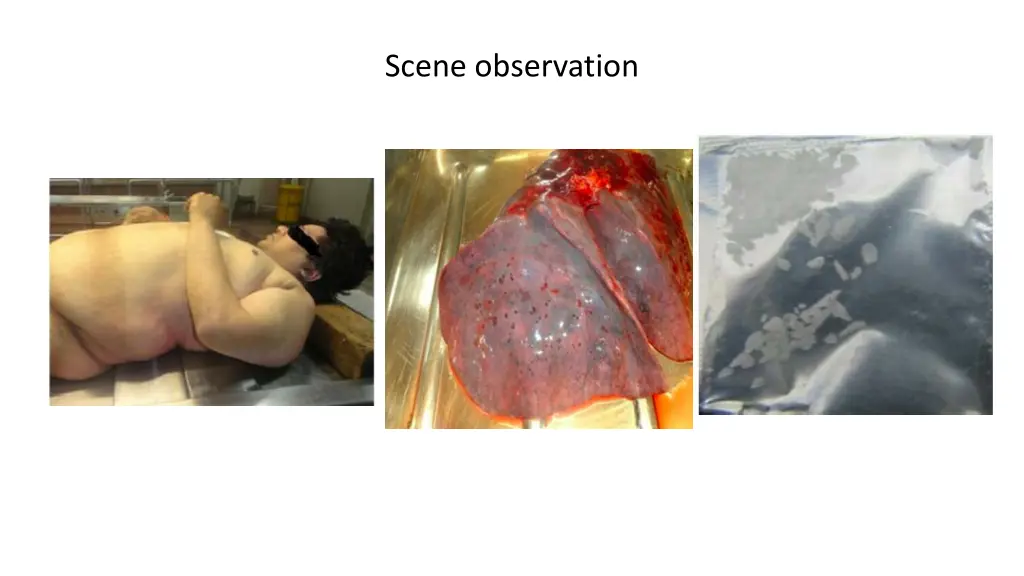 scene observation