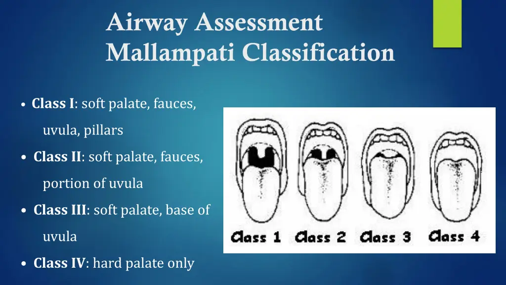 airway assessment mallampati classification
