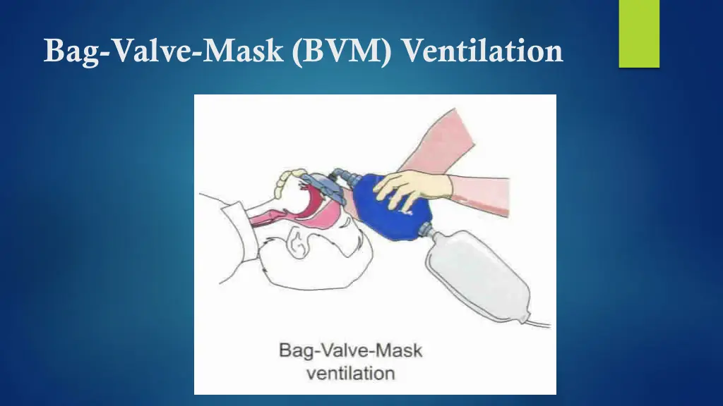 bag valve mask bvm ventilation