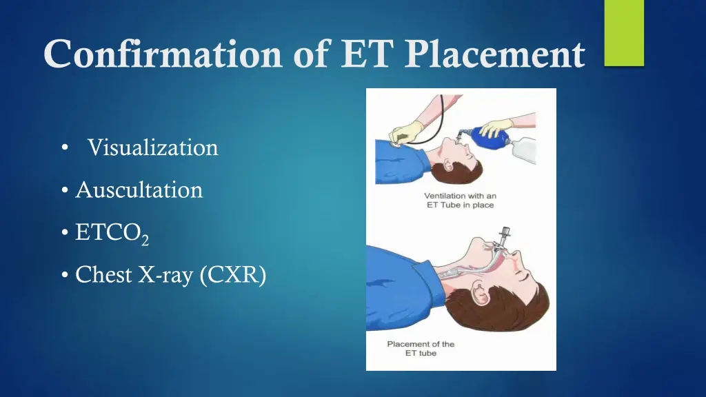 confirmation of et placement