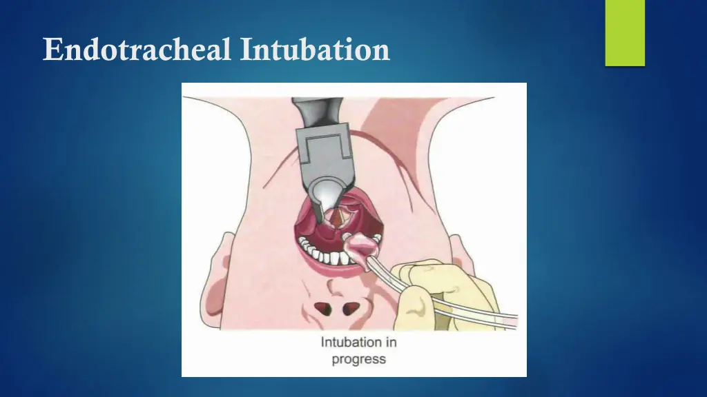 endotracheal intubation