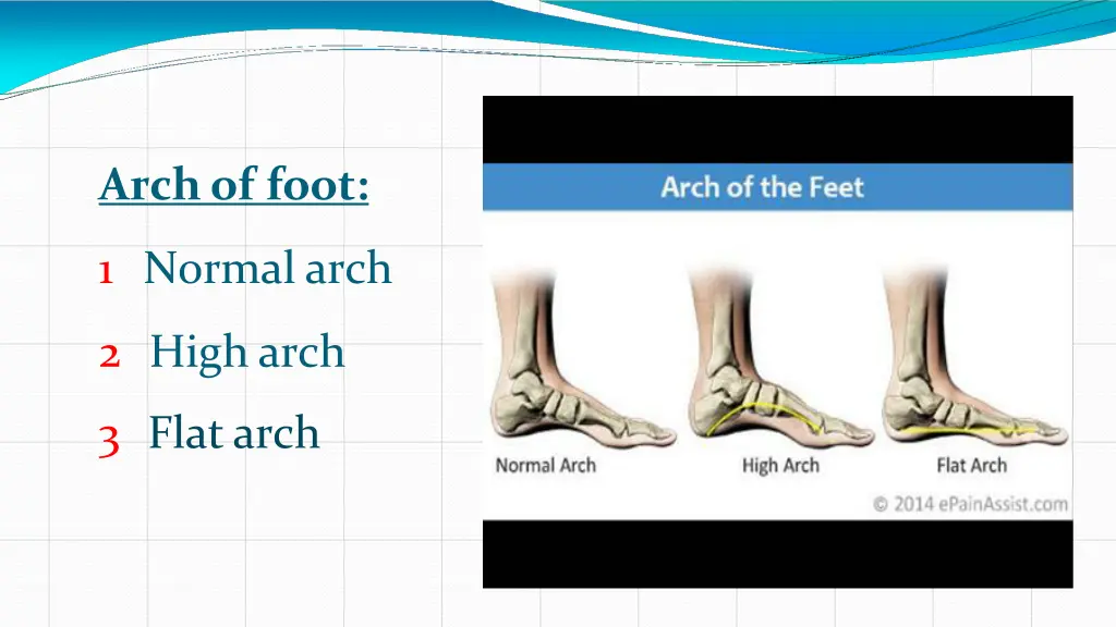 arch of foot