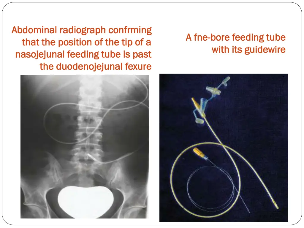 abdominal radiograph abdominal radiograph