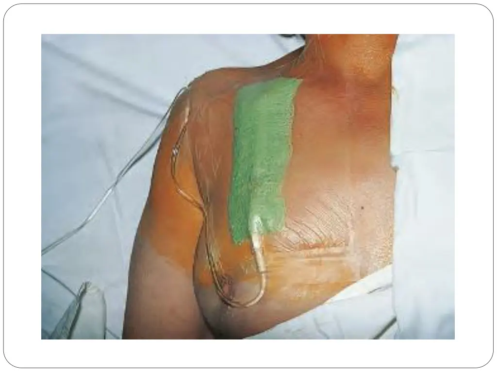 slide50