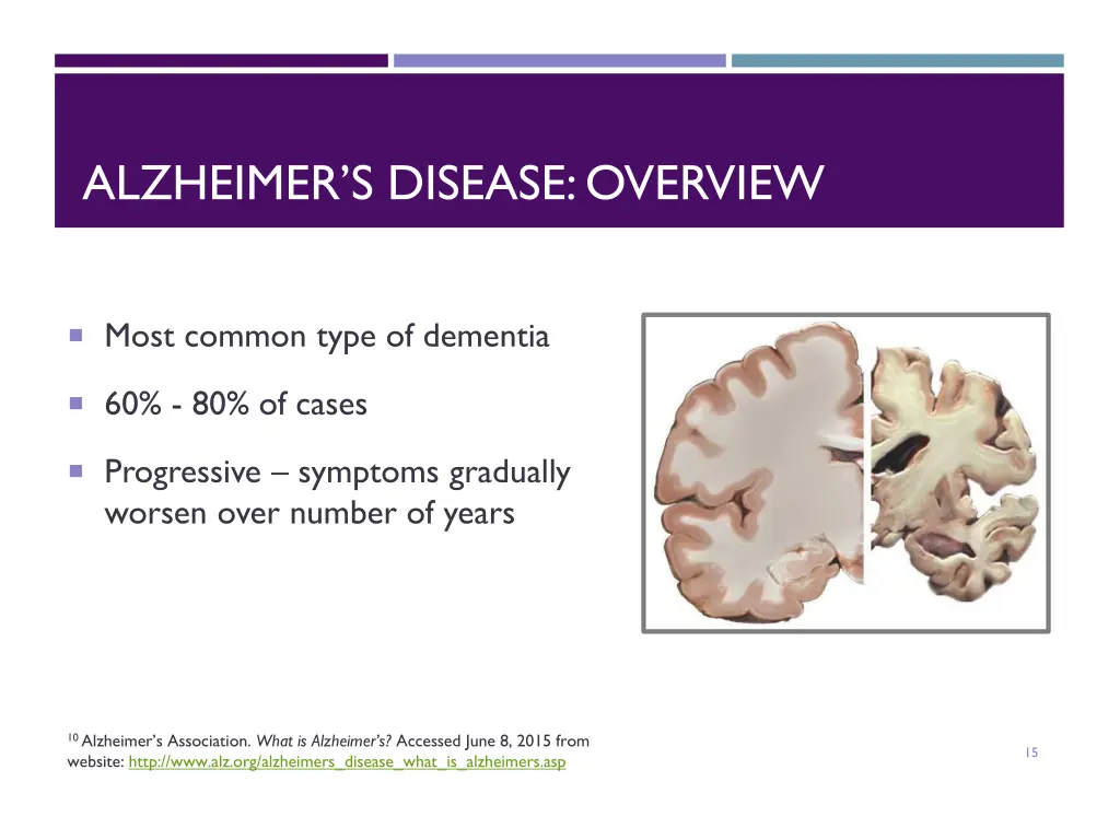 alzheimer s disease overview