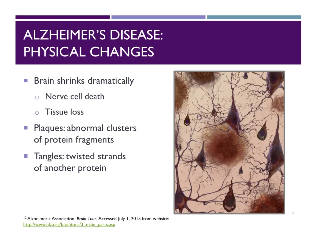 alzheimer s disease physical changes
