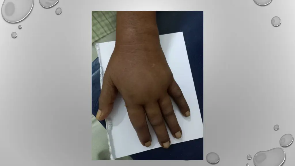 slide6