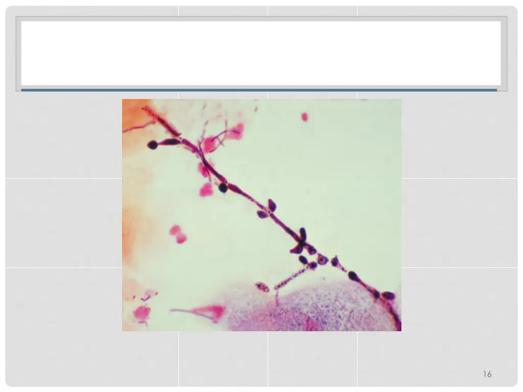 slide17