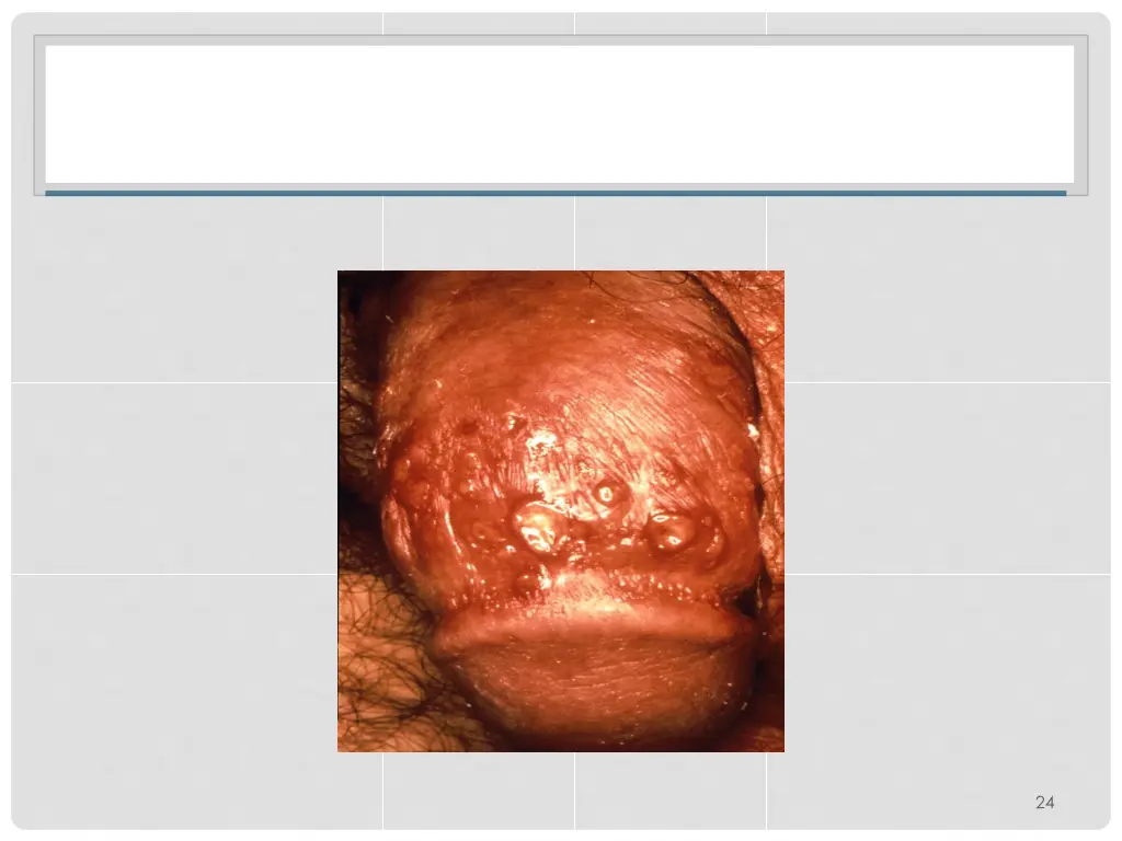 slide25