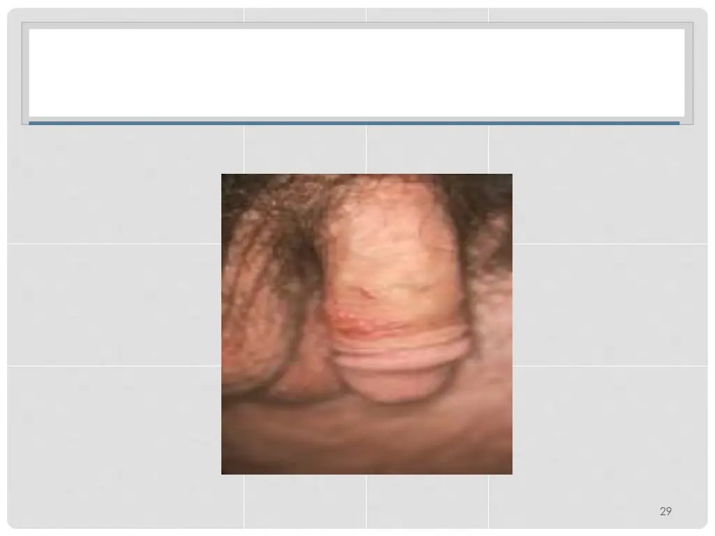 slide30