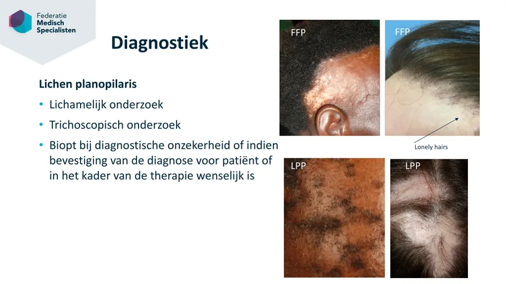 slide23