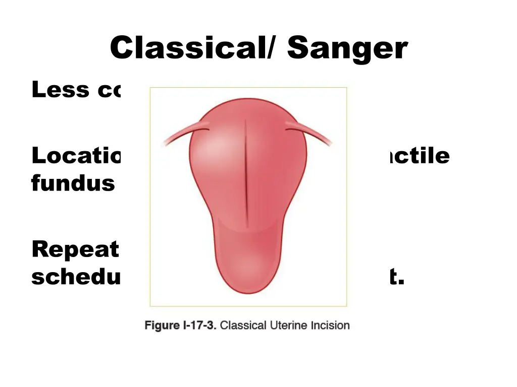 classical sanger less commonly performed