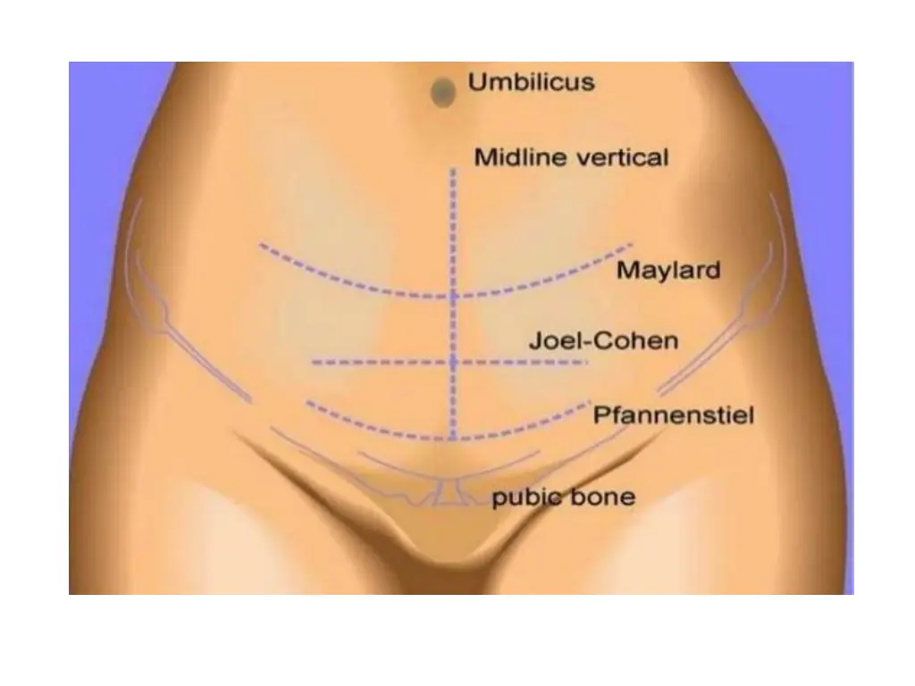 slide14