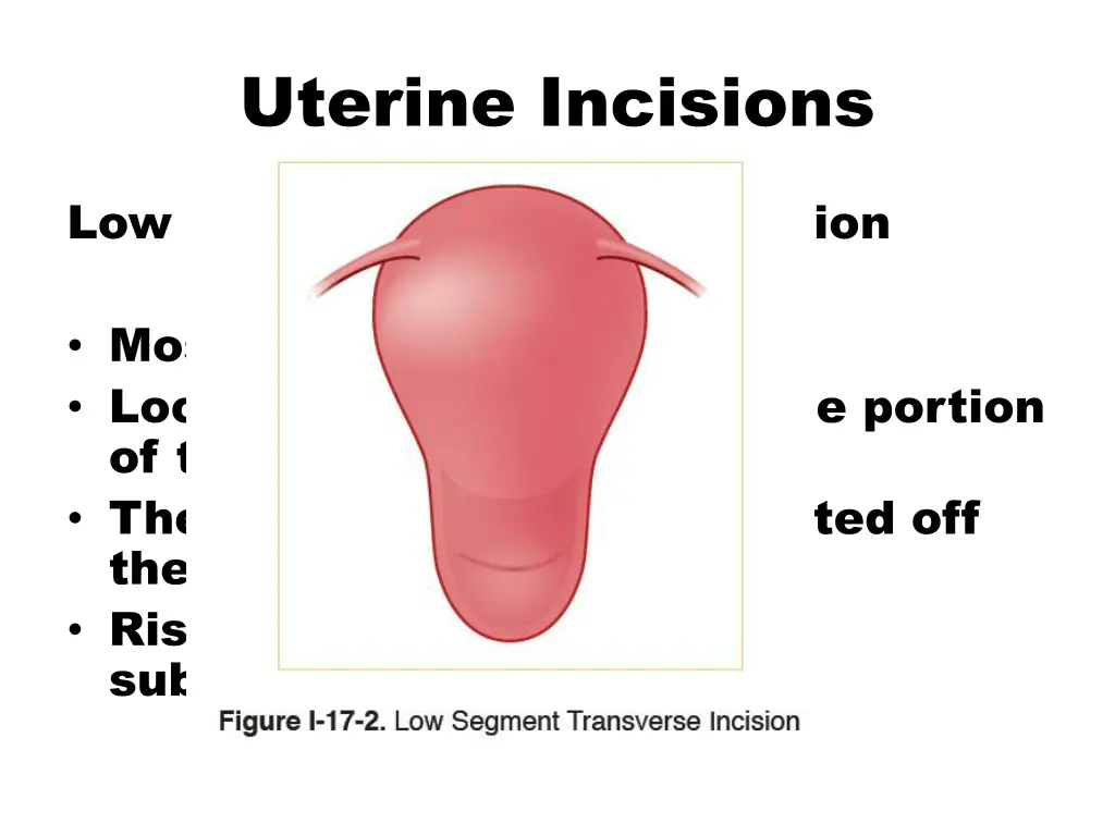 uterine incisions