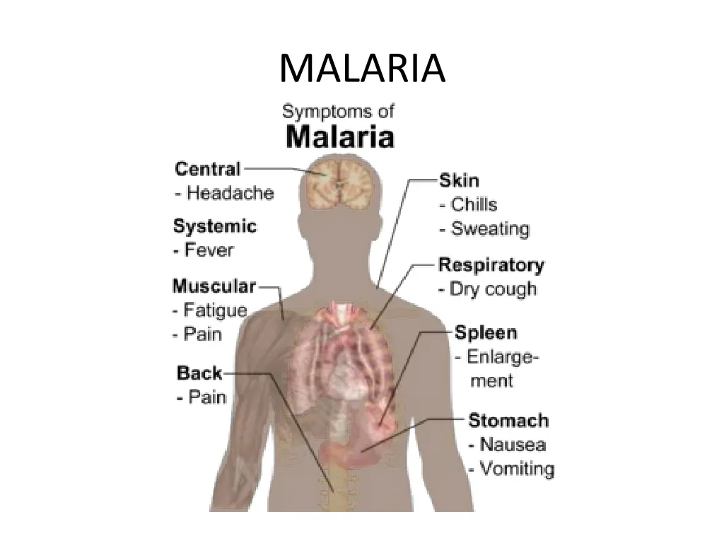 malaria