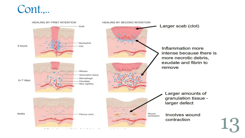 slide13