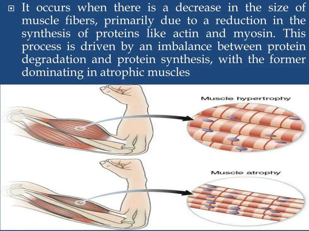 it occurs when there is a decrease in the size
