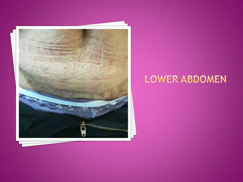 lower abdomen