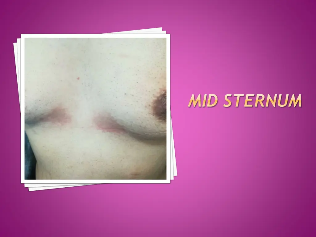 mid sternum