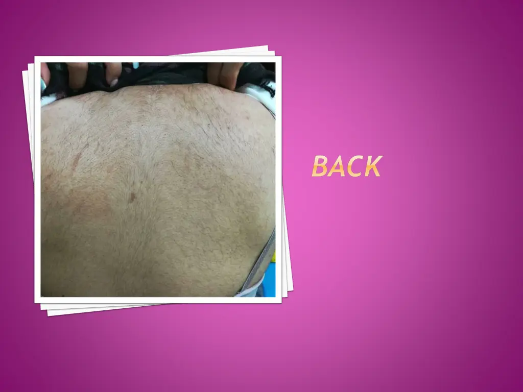 slide17