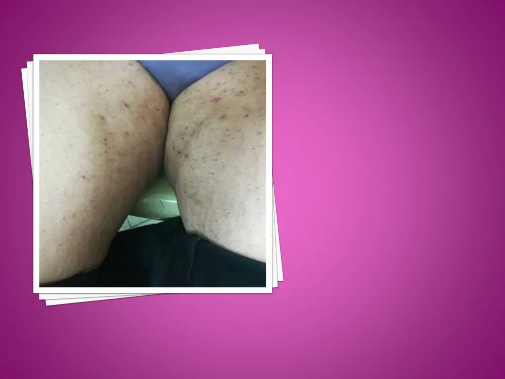 slide18