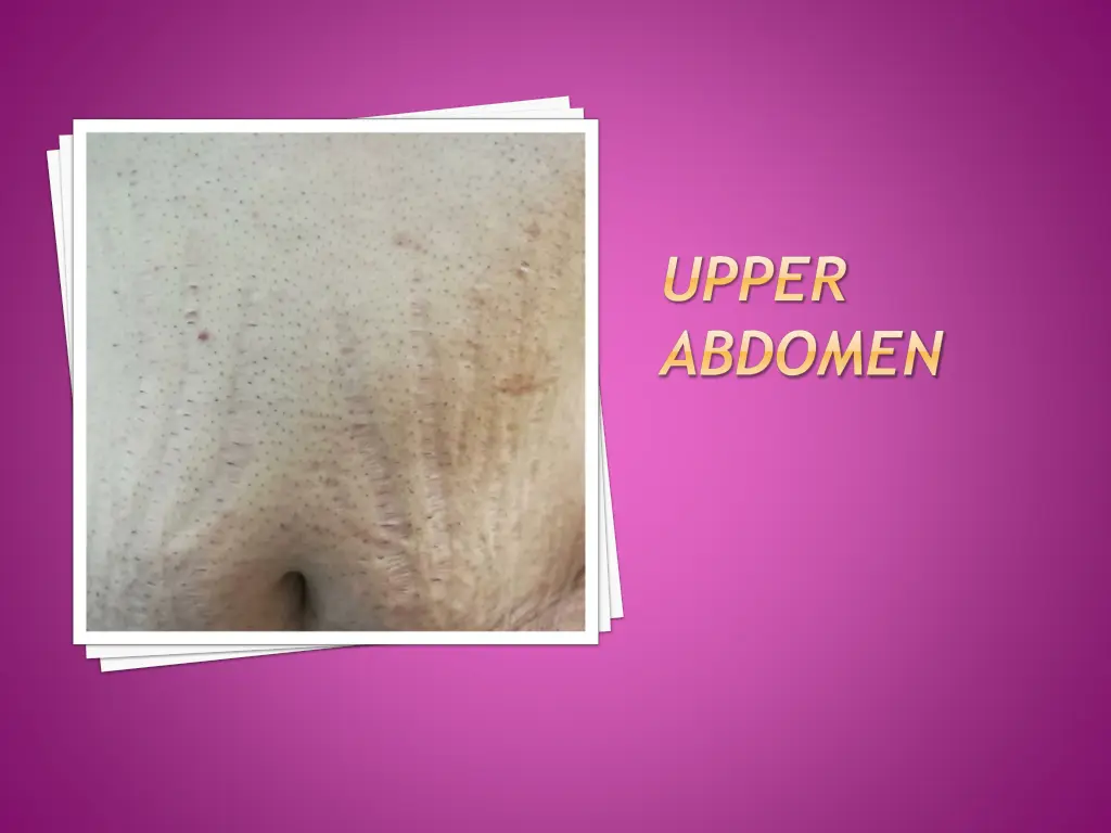 upper abdomen