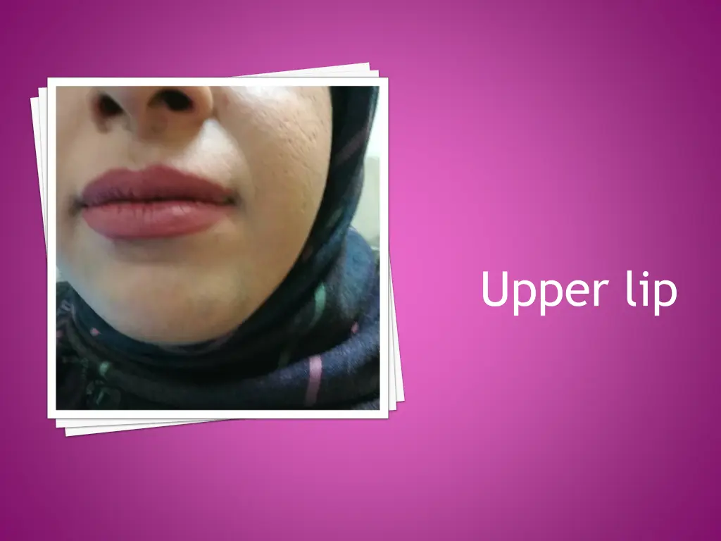 upper lip