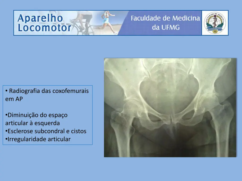 radiografia das coxofemurais em ap