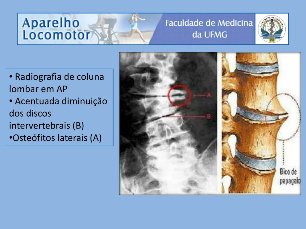 radiografia de coluna lombar em ap acentuada