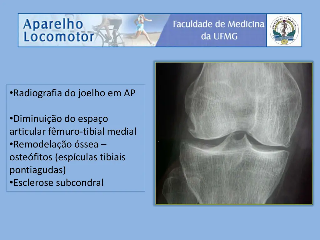 radiografia do joelho em ap