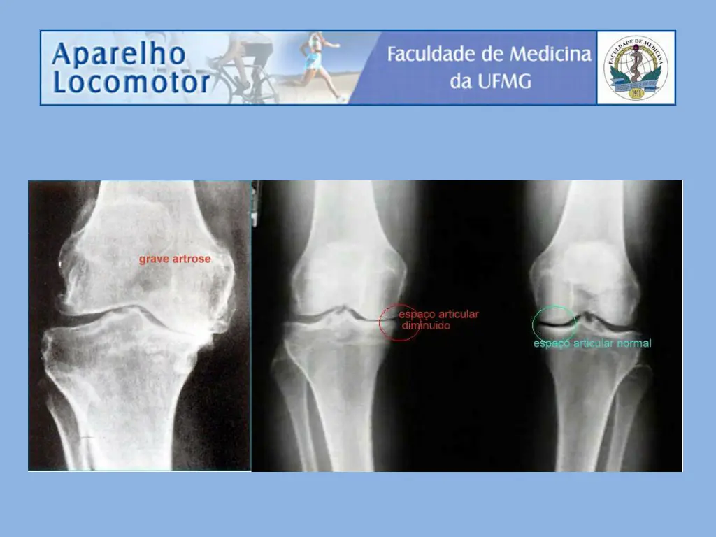 slide11
